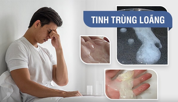 tinh trùng loãng là gì?